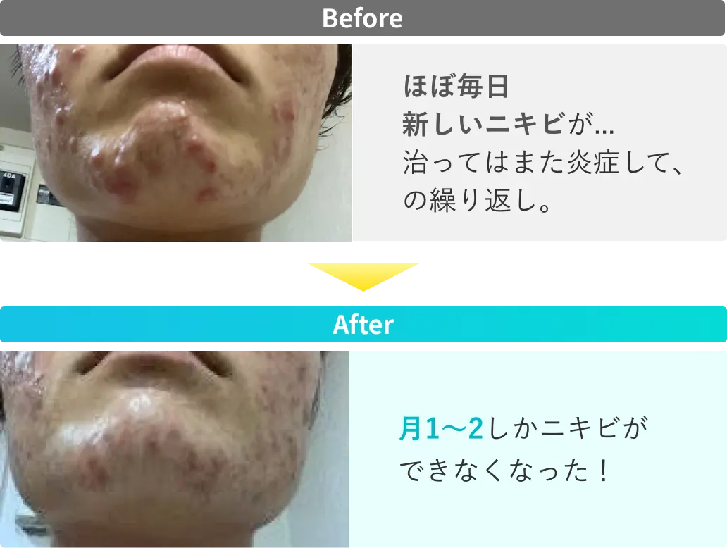 1人目のビフォーアフター