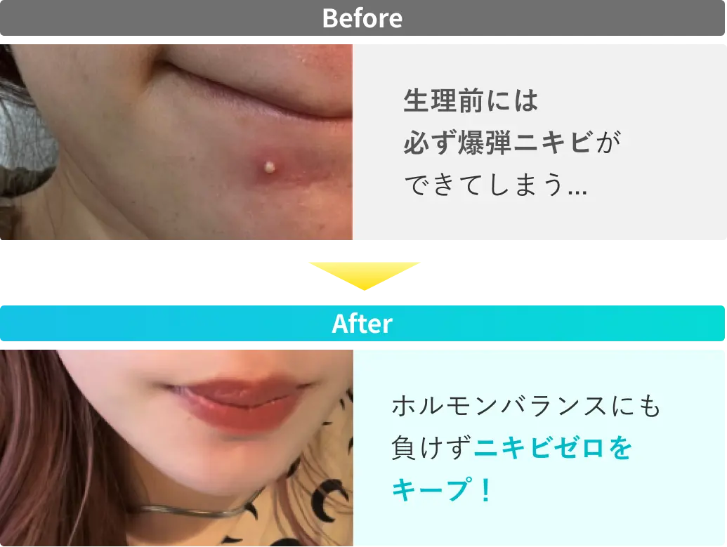 2人目のビフォーアフター